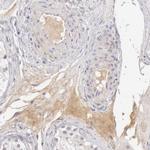 Complement Factor I Antibody in Immunohistochemistry (Paraffin) (IHC (P))
