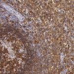 Lyn Antibody in Immunohistochemistry (Paraffin) (IHC (P))