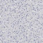 DMC1 Antibody in Immunohistochemistry (Paraffin) (IHC (P))