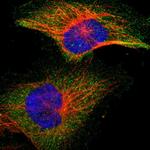 IKK beta Antibody in Immunocytochemistry (ICC/IF)