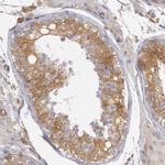 IKK beta Antibody in Immunohistochemistry (Paraffin) (IHC (P))