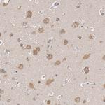 HDJ2 Antibody in Immunohistochemistry (Paraffin) (IHC (P))