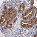 HDJ2 Antibody in Immunohistochemistry (Paraffin) (IHC (P))