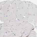 HDJ2 Antibody in Immunohistochemistry (Paraffin) (IHC (P))