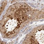 HDJ2 Antibody in Immunohistochemistry (Paraffin) (IHC (P))