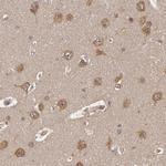 USP14 Antibody in Immunohistochemistry (Paraffin) (IHC (P))