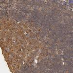 USP14 Antibody in Immunohistochemistry (Paraffin) (IHC (P))