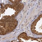 USP14 Antibody in Immunohistochemistry (Paraffin) (IHC (P))