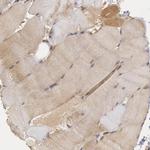 USP14 Antibody in Immunohistochemistry (Paraffin) (IHC (P))