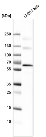 USP14 Antibody in Western Blot (WB)
