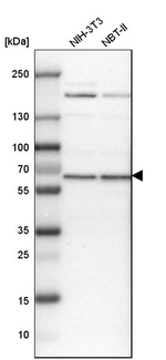 USP14 Antibody in Western Blot (WB)