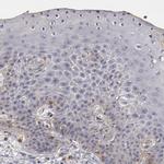 Flotillin 1 Polyclonal Antibody