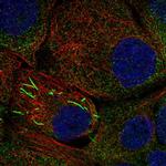 IMPDH2 Polyclonal Antibody