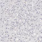 IMPDH2 Antibody in Immunohistochemistry (Paraffin) (IHC (P))