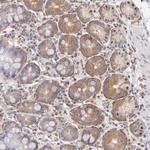 IMPDH2 Antibody in Immunohistochemistry (Paraffin) (IHC (P))