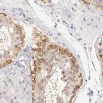 IMPDH2 Antibody in Immunohistochemistry (Paraffin) (IHC (P))