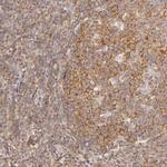 IMPDH2 Antibody in Immunohistochemistry (Paraffin) (IHC (P))