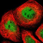 IKK alpha Polyclonal Antibody