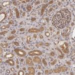 IKK alpha Antibody in Immunohistochemistry (Paraffin) (IHC (P))