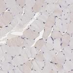 IKK alpha Antibody in Immunohistochemistry (Paraffin) (IHC (P))