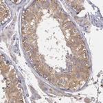 NEK9 Antibody in Immunohistochemistry (Paraffin) (IHC (P))