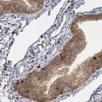 SHP-1 Antibody in Immunohistochemistry (Paraffin) (IHC (P))