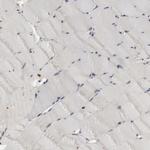 SHP-1 Antibody in Immunohistochemistry (Paraffin) (IHC (P))