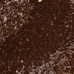 SHP-1 Antibody in Immunohistochemistry (Paraffin) (IHC (P))