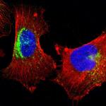 STX7 Polyclonal Antibody