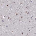 STX7 Antibody in Immunohistochemistry (Paraffin) (IHC (P))
