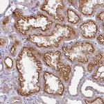 STX7 Antibody in Immunohistochemistry (Paraffin) (IHC (P))