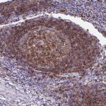 STX7 Antibody in Immunohistochemistry (Paraffin) (IHC (P))