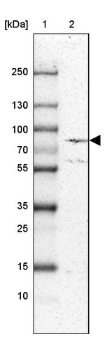 ECE1 Antibody in Western Blot (WB)