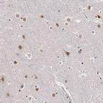 PLZF Polyclonal Antibody