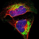 ATP Synthase beta Polyclonal Antibody