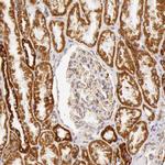 ATP Synthase beta Antibody in Immunohistochemistry (Paraffin) (IHC (P))