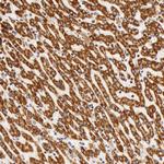 ATP Synthase beta Antibody in Immunohistochemistry (Paraffin) (IHC (P))