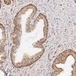 ATP Synthase beta Antibody in Immunohistochemistry (Paraffin) (IHC (P))