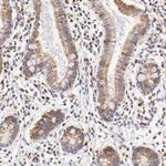 ATP Synthase beta Antibody in Immunohistochemistry (Paraffin) (IHC (P))
