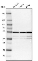 ATP Synthase beta Antibody in Western Blot (WB)