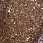 ZNF350 Antibody in Immunohistochemistry (Paraffin) (IHC (P))