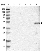 ZNF350 Antibody in Western Blot (WB)