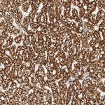 ATP Synthase beta Antibody in Immunohistochemistry (Paraffin) (IHC (P))