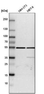 ATP Synthase beta Antibody in Western Blot (WB)