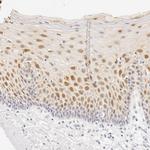 Galectin 7 Polyclonal Antibody