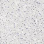 Galectin 7 Antibody in Immunohistochemistry (Paraffin) (IHC (P))