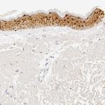 Galectin 7 Antibody in Immunohistochemistry (Paraffin) (IHC (P))