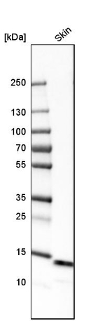 Galectin 7 Antibody in Western Blot (WB)
