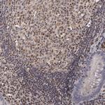 ELK3 Antibody in Immunohistochemistry (Paraffin) (IHC (P))