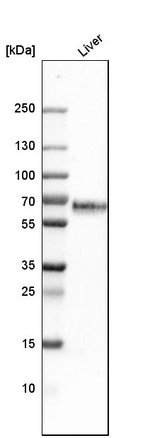 Kininogen 1 Antibody in Western Blot (WB)